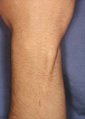 Anatomy 2026 MCQs: Board Review Questions & Answers (Part 4) - Figure 27