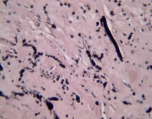 Basic Science 2000 Practice Questions: Set 1 (Solved) - Figure 15
