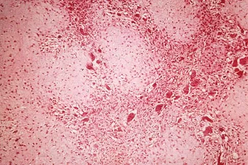 Basic Science 2000 Practice Questions: Set 1 (Solved) - Figure 20