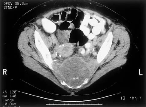 Basic Science 2000 Practice Questions: Set 1 (Solved) - Figure 23