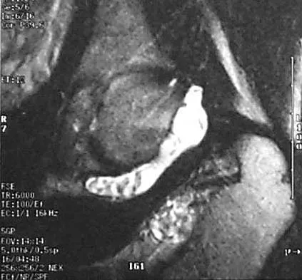 Basic Science 2000 Practice Questions: Set 1 (Solved) - Figure 30