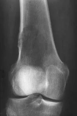 Basic Science 2000 Practice Questions: Set 1 (Solved) - Figure 38