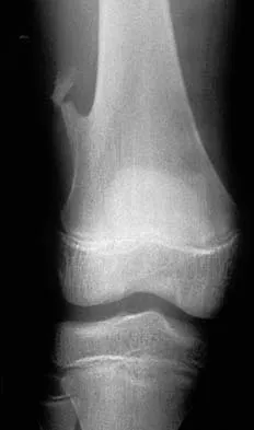 Basic Science 2000 Practice Questions: Set 1 (Solved) - Figure 39