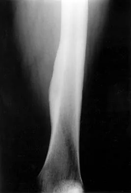 Basic Science 2000 Practice Questions: Set 1 (Solved) - Figure 42