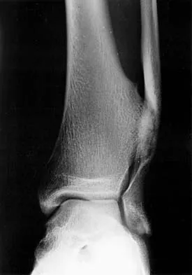 Click to enlarge Basic Science Board Review 2000: High-Yield MCQs (Set 2) - Figure 25