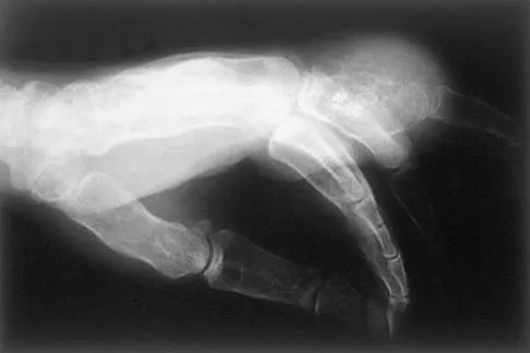 Basic Science Board Review 2000: High-Yield MCQs (Set 2) - Figure 32