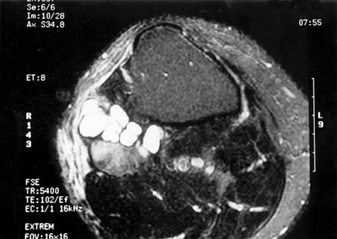 Basic Science Board Review 2000: High-Yield MCQs (Set 2) - Figure 41