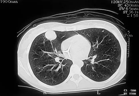 Basic Science Board Review 2000: High-Yield MCQs (Set 2) - Figure 44