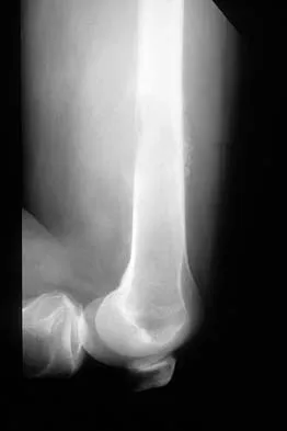 Basic Science Board Review 2000: High-Yield MCQs (Set 2) - Figure 46