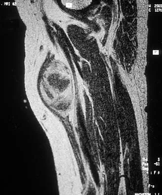 Basic Science 2000 Practice Questions: Set 3 (Solved) - Figure 12