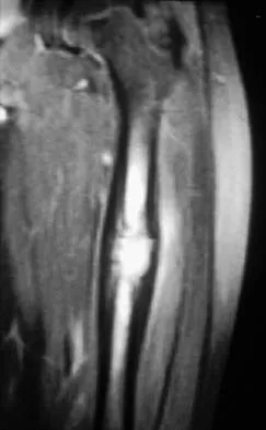 Basic Science 2000 Practice Questions: Set 3 (Solved) - Figure 21