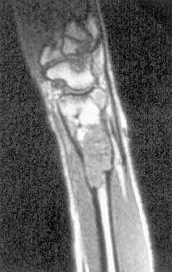 Basic Science 2000 Practice Questions: Set 3 (Solved) - Figure 4