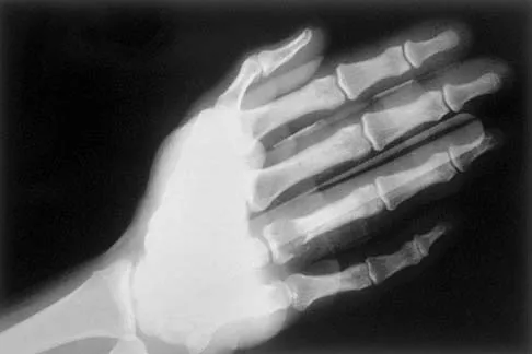 Orthopedic Basic Science MCQs (Set 4): Biomechanics, Bone Physiology & Biomaterials | AAOS, ABOS Review