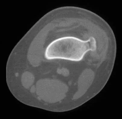 Basic Science Board Review 2000: High-Yield MCQs (Set 4) - Figure 12