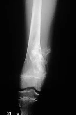 Basic Science Board Review 2000: High-Yield MCQs (Set 4) - Figure 13