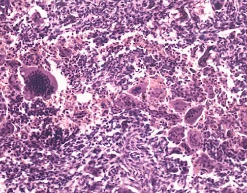 Basic Science Board Review 2000: High-Yield MCQs (Set 4) - Figure 18