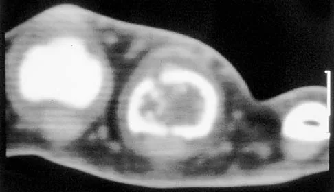 Basic Science Board Review 2000: High-Yield MCQs (Set 4) - Figure 2