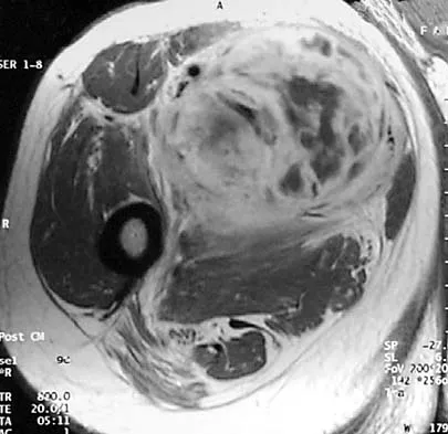 Basic Science Board Review 2000: High-Yield MCQs (Set 4) - Figure 20