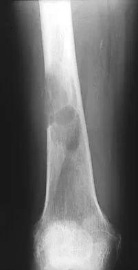 Basic Science Board Review 2000: High-Yield MCQs (Set 4) - Figure 21