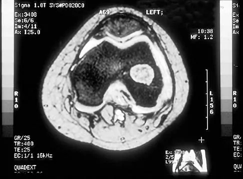 Basic Science Board Review 2000: High-Yield MCQs (Set 4) - Figure 6