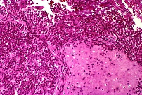 Basic Science Board Review 2000: High-Yield MCQs (Set 4) - Figure 8