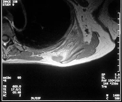Basic Science 2002 Practice Questions: Set 1 (Solved) - Figure 14