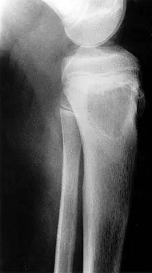 Basic Science 2002 Practice Questions: Set 1 (Solved) - Figure 19