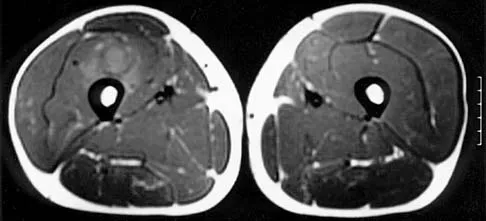 Basic Science 2002 Practice Questions: Set 1 (Solved) - Figure 27