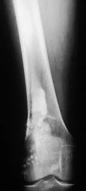 Basic Science 2002 Practice Questions: Set 1 (Solved) - Figure 45