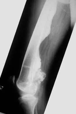 Basic Science 2002 Practice Questions: Set 1 (Solved) - Figure 46