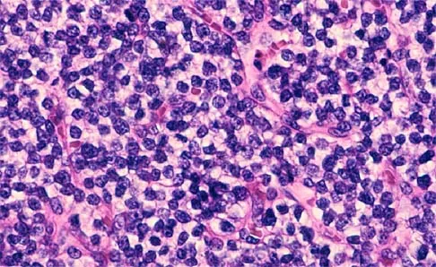 Click to enlarge Basic Science 2002 Practice Questions: Set 1 (Solved) - Figure 9