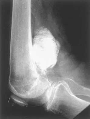 AAOS Basic Science MCQs (Set 2): Bone Physiology & Biomechanics | 2002 Board Review