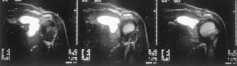Basic Science Board Review 2002: High-Yield MCQs (Set 2) - Figure 17
