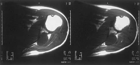 Basic Science Board Review 2002: High-Yield MCQs (Set 2) - Figure 18