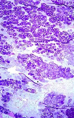 Basic Science Board Review 2002: High-Yield MCQs (Set 2) - Figure 34