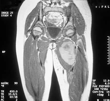 Basic Science Board Review 2002: High-Yield MCQs (Set 2) - Figure 49