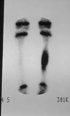Basic Science Board Review 2002: High-Yield MCQs (Set 2) - Figure 8