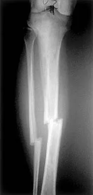 Basic Science 2002 Practice Questions: Set 3 (Solved) - Figure 1