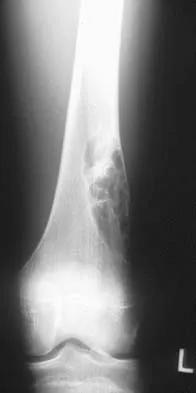 Basic Science 2002 Practice Questions: Set 3 (Solved) - Figure 18