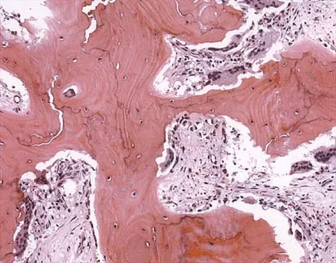 Basic Science 2002 Practice Questions: Set 3 (Solved) - Figure 2