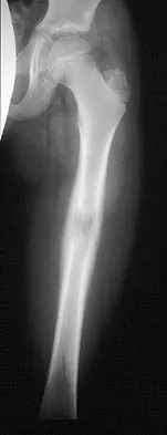 Basic Science 2002 Practice Questions: Set 3 (Solved) - Figure 20