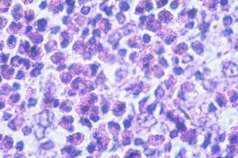 Basic Science 2002 Practice Questions: Set 3 (Solved) - Figure 23