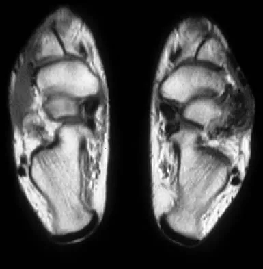 Basic Science 2002 Practice Questions: Set 3 (Solved) - Figure 27