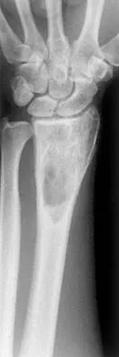 Basic Science 2002 Practice Questions: Set 3 (Solved) - Figure 3