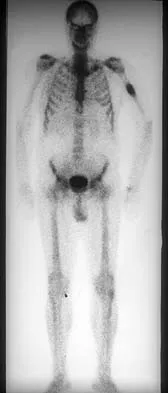 Basic Science 2002 Practice Questions: Set 3 (Solved) - Figure 31