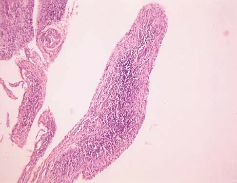 Basic Science 2002 Practice Questions: Set 3 (Solved) - Figure 7