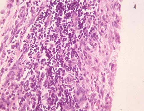 Basic Science 2002 Practice Questions: Set 3 (Solved) - Figure 8