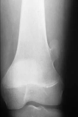 Basic Science Board Review 2002: High-Yield MCQs (Set 4) - Figure 10
