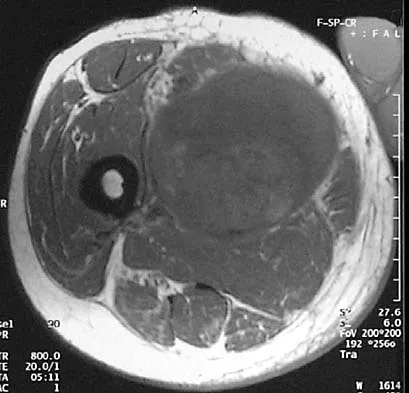 Basic Science Board Review 2002: High-Yield MCQs (Set 4) - Figure 19