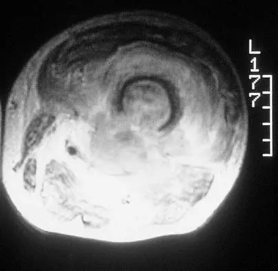 Basic Science Board Review 2002: High-Yield MCQs (Set 4) - Figure 31